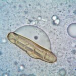 microorganism under a microscope