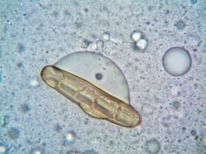 microorganism under a microscope
